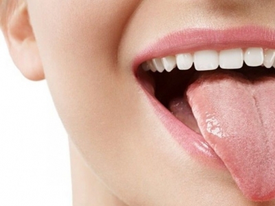 Análisis de lengua: lo que cuenta sobre tu salud