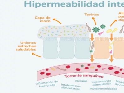 Entrevista en Innatia - Todo lo que necesitas saber del Intestino Permeable